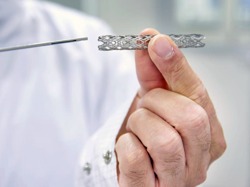 Stent Nedir?